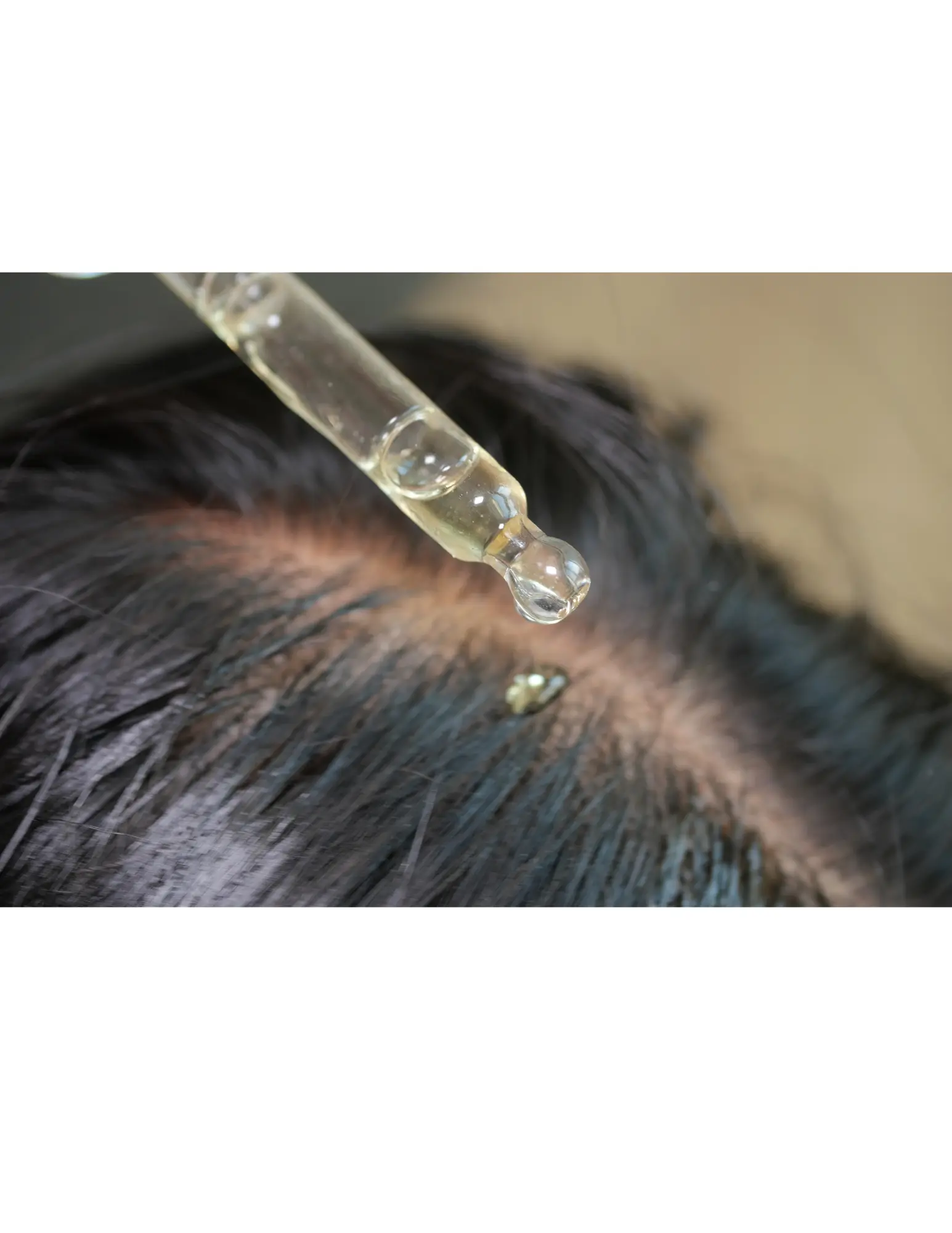 Hair Health & Hair Loss Optimization